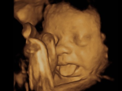 3DBabyVu 3D Ultrasound Photo, Baby Jameson In the Womb